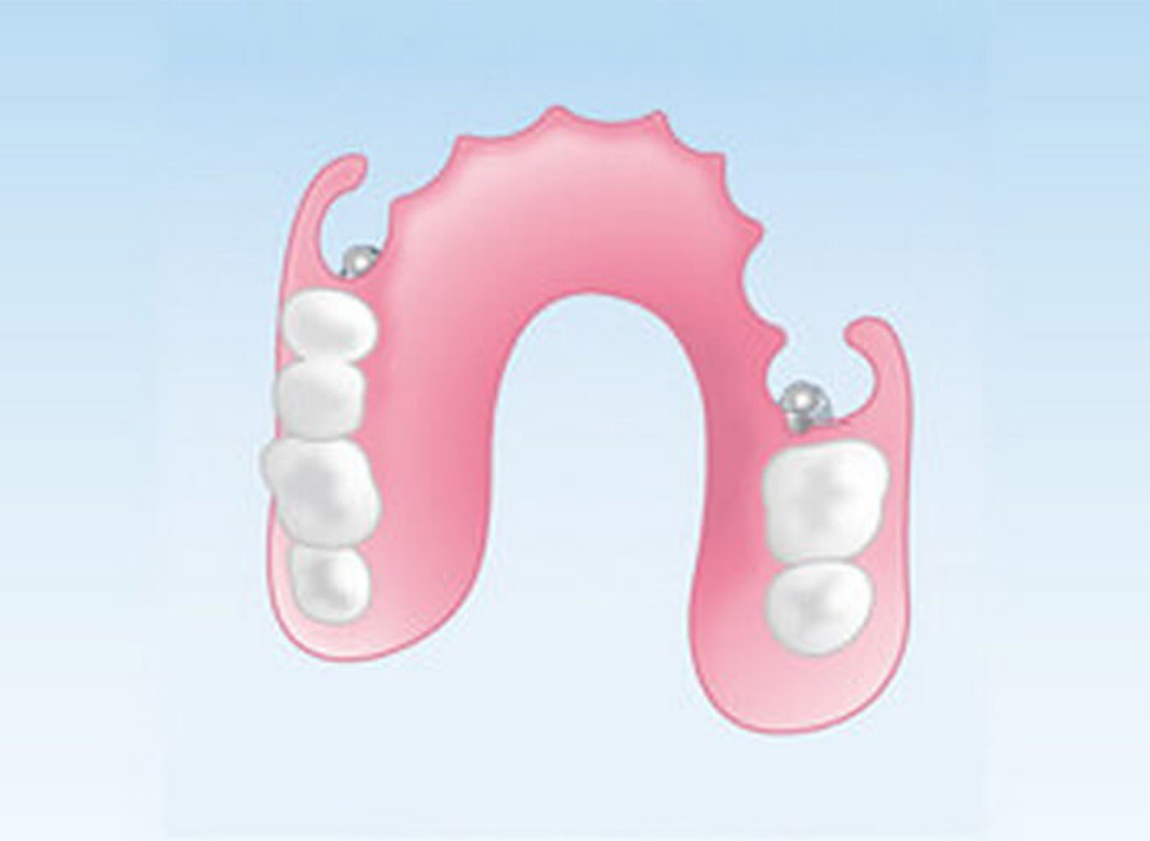 入れ歯｜前橋市関根町の歯医者・歯科医院なら【リップル歯科・矯正歯科クリニック】