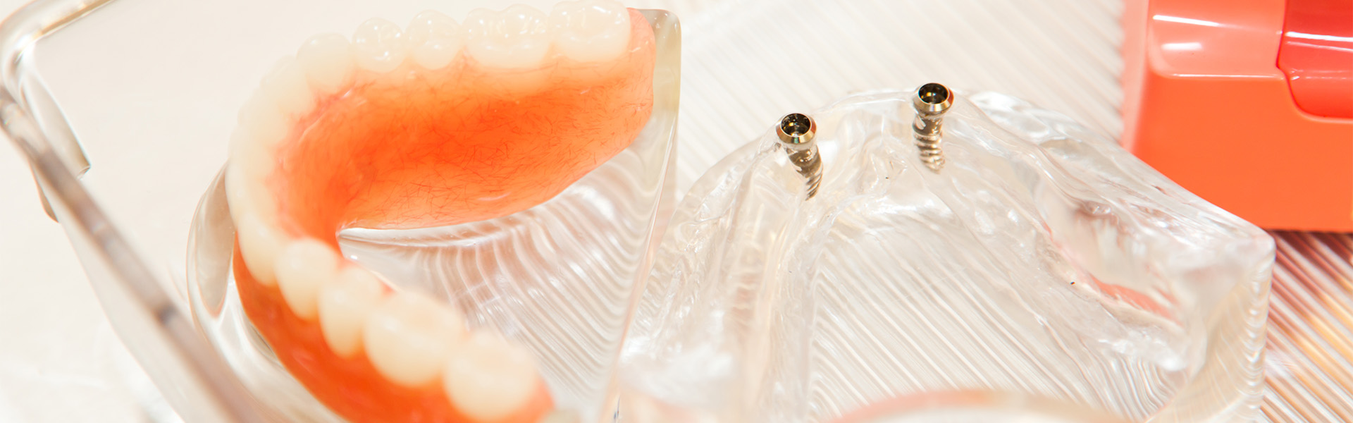 入れ歯｜前橋市関根町の歯医者・歯科医院なら【リップル歯科・矯正歯科クリニック】