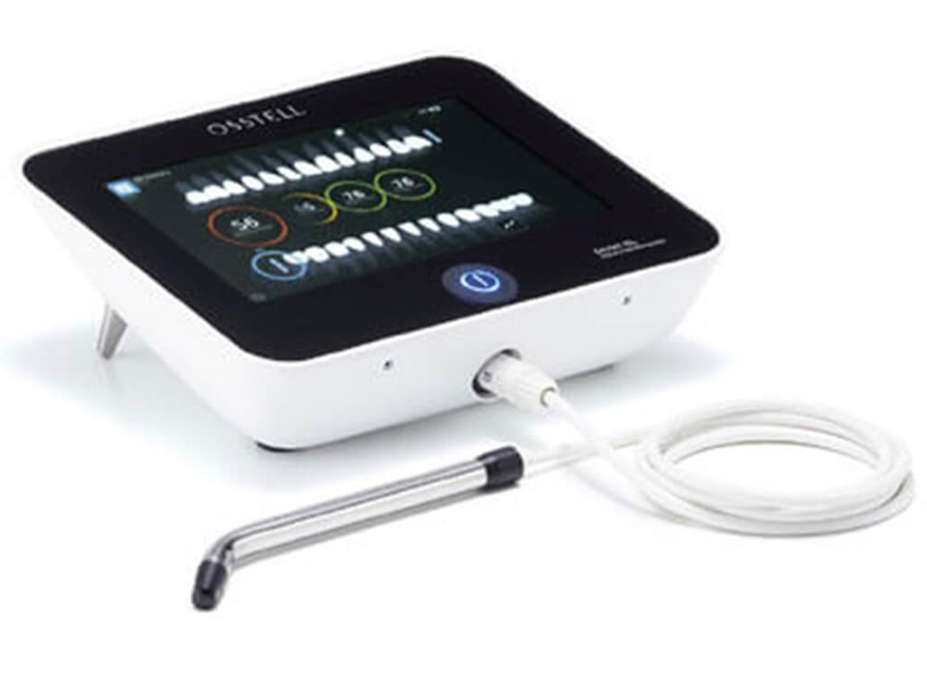 歯周病はどのような病気ですか？