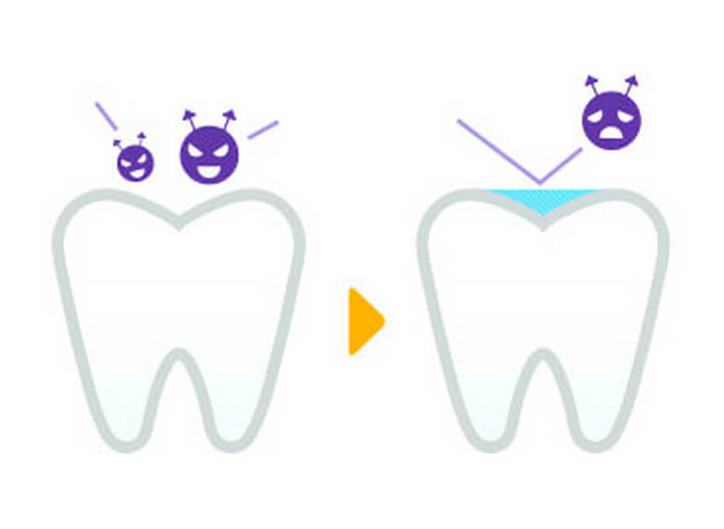 小児歯科｜前橋市関根町の歯医者・歯科医院なら【リップル歯科・矯正歯科クリニック】