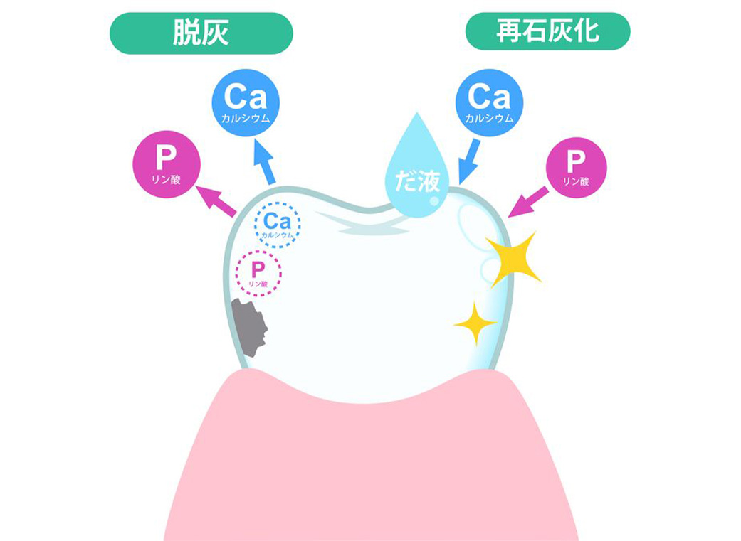 定期検診｜前橋市の歯医者【リップル歯科・矯正歯科クリニック】
