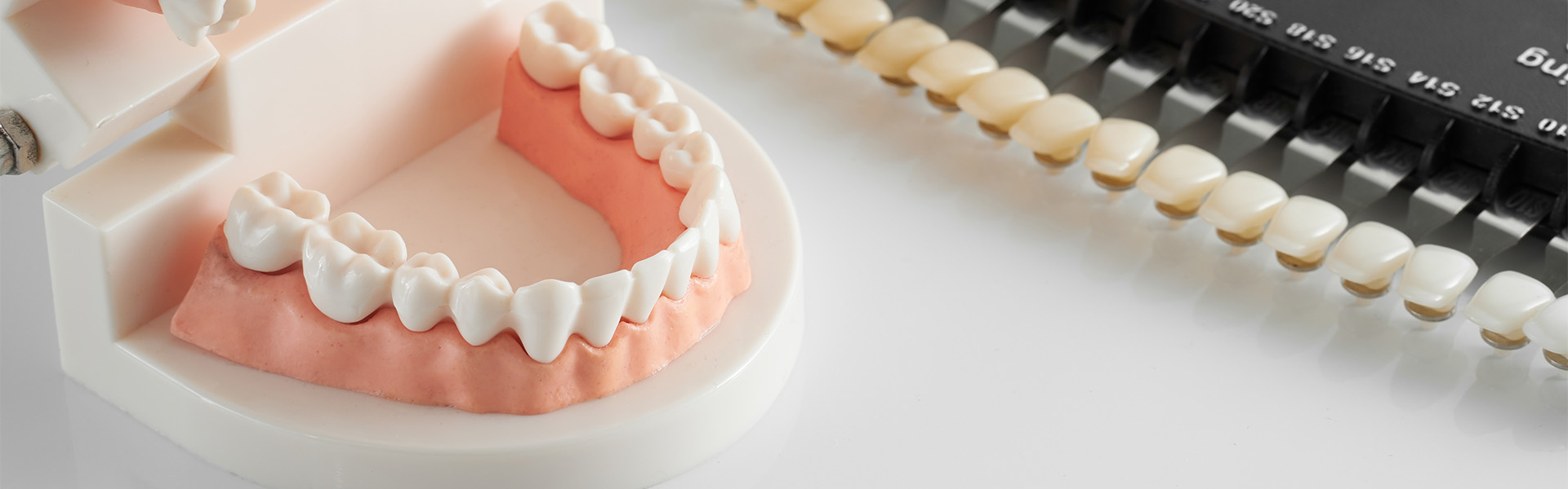 ホワイトニング｜前橋市関根町の歯医者・歯科医院なら【リップル歯科・矯正歯科クリニック】